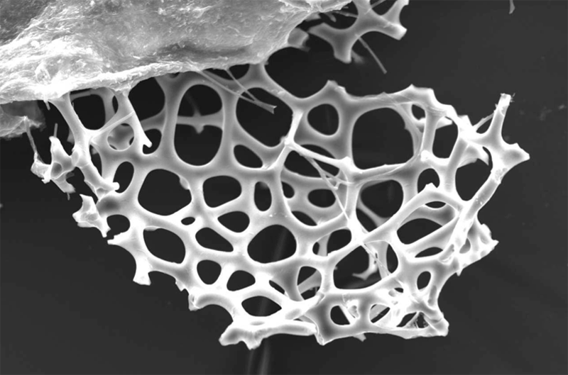 Eliza Carter '18 submitted a scanning electron microscope image of the shell of a radiolarian (a protozoa) found near the top of an Antarctic sediment core from ODP site 697. The radiolarian shell is around 2.7 million years old and is made from silica that was produced by the radiolarian. Studying the percent biogenic silica in a sediment sample is a proxy for primary productivity: the more biosilica you have, the more productive it was.