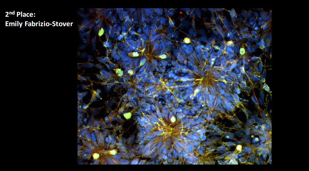 Emily Fabrizio-Stover Embryonic stem cells differentiating into neurons in vitro from neural rosettes, a structure of radially arranged neural stem cells. Because these structures share properties with the neural tube, they can be used to model neurogenesis. Immunocytochemistry highlights the nuclei in blue (Hoechst) and cells in mitosis in yellow (Phospho-histone H3 in green and Numb in red).