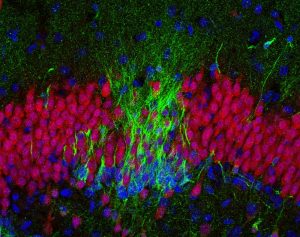 In the brain of a baby who died soon after birth, there are many new neurons (green in this image) in the hippocampus. (Photo illustration by Sorrells et al, CC BY-ND)
