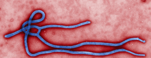 Ebola is a rare and deadly disease caused by infection with one of the Ebola virus strains. Ebola can cause disease in humans and nonhuman primates. Ebola was first discovered in 1976 near the Ebola River in what is now the Democratic Republic of the Congo. Since then, outbreaks have appeared sporadically in Africa. (Photo courteously of the Centers for Disease Control and Prevention)