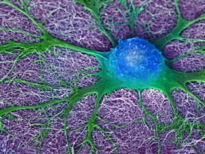 A mouse neural stem cell (blue and green) grows in a lab dish. Can human brain cells do what rodent brain cells do? (Photo illustration by Mark McClendon, Zaida Alvarez Pinto, Samuel I. Stupp, Northwestern University, Evanston, IL, CC BY-NC)